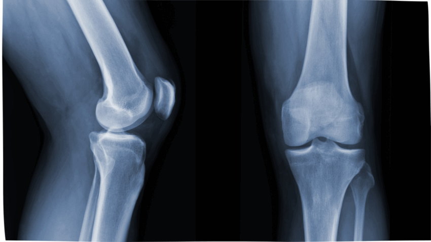image rhumatologie spécialité-grande clinique du nord